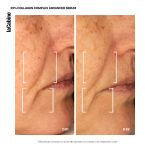 25-collagen-complex-advanced-serum