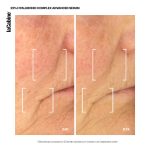 25-hyaluronic-complex-advanced-serum