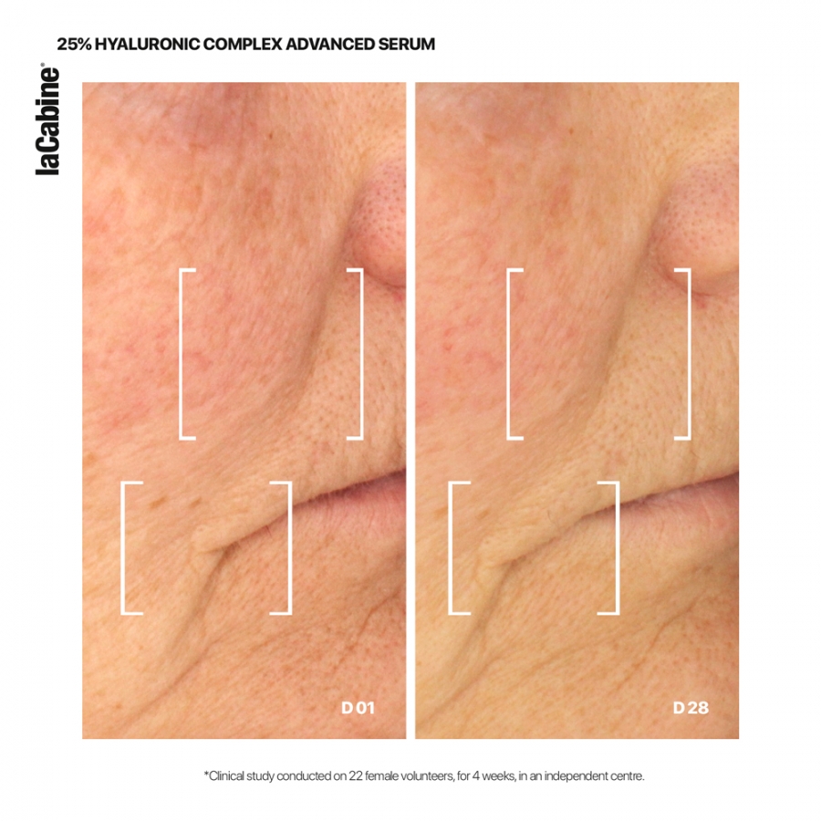 25-hyaluronic-complex-advanced-serum (3)