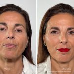 flash-effect-ampoules