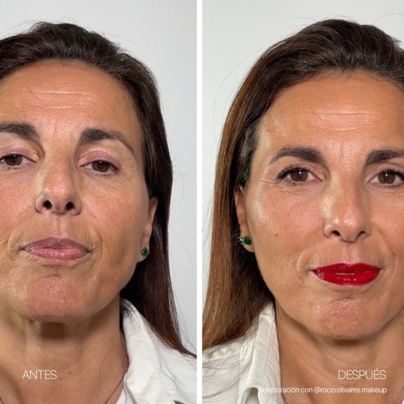 flash-effect-ampoules (1)