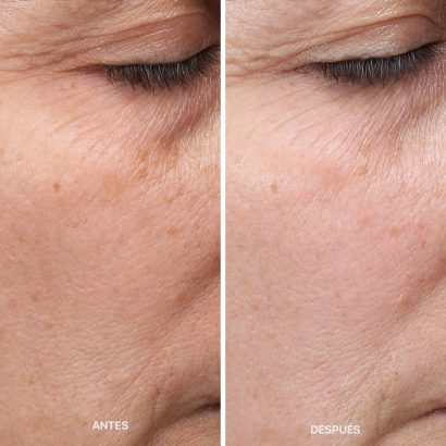 antes-despues-metodo-laCabine-6