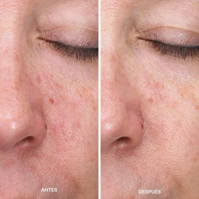 antes-despues-metodo-laCabine-7