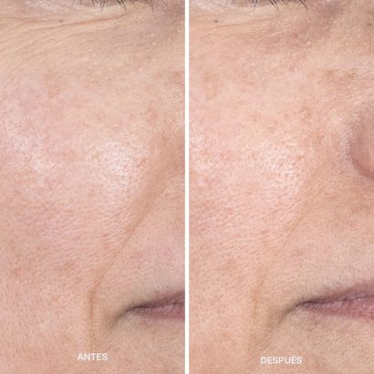 antes-despues-metodo-laCabine-8